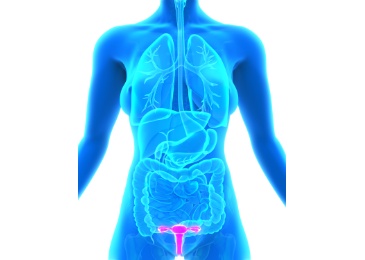 Endometriose